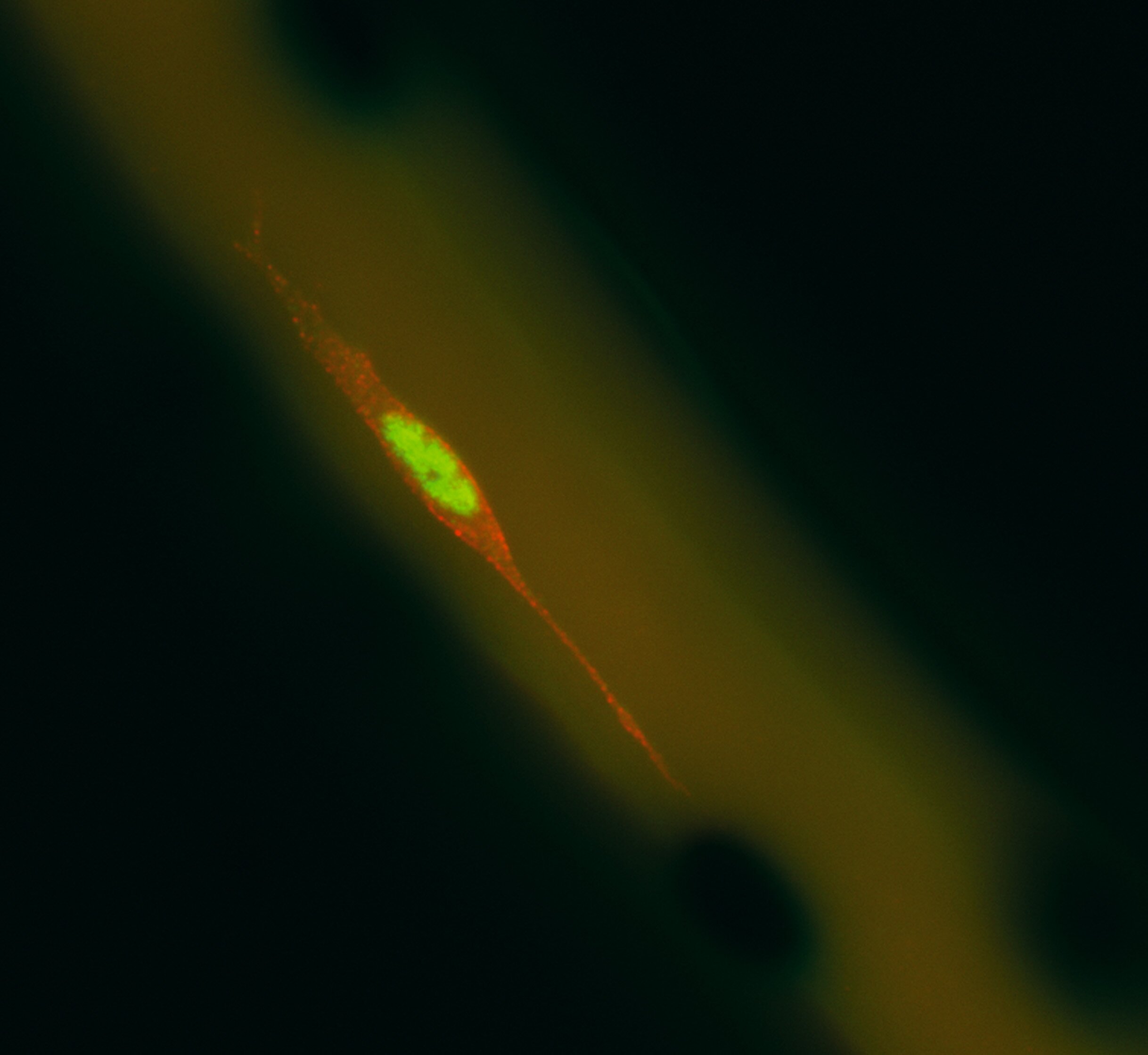 A satellite cell on a muscle fibre (Image credit: 